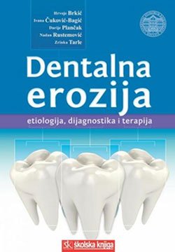 Dentalna erozija - etiologija, dijagnostika i terapija