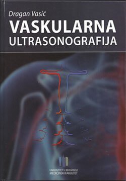 Vaskularna ultrasonografija