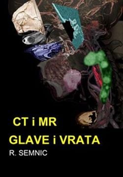 CT i MR glave i vrata