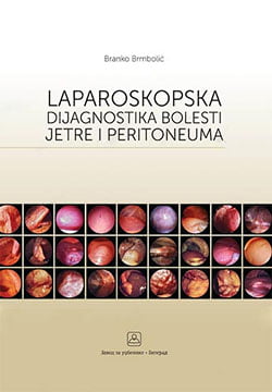 Laparoskopska dijagnostika