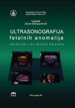 Ultrasonografija fetalnih anomalija