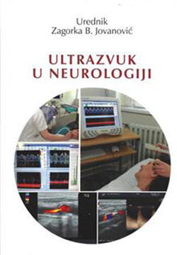 Ultrazvuk u neurologiji