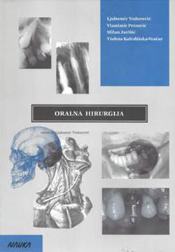 Oralna hirurgija